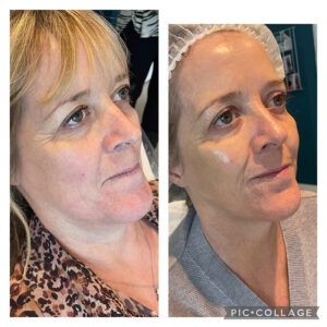 Sunekos Performa Sunekos Performa