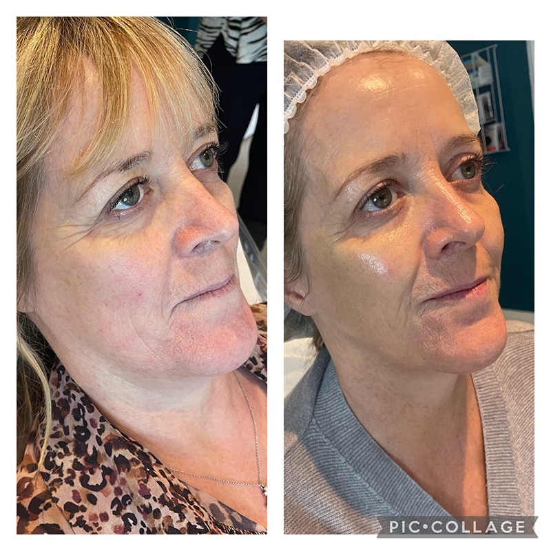 Sunekos Performa Sunekos Performa