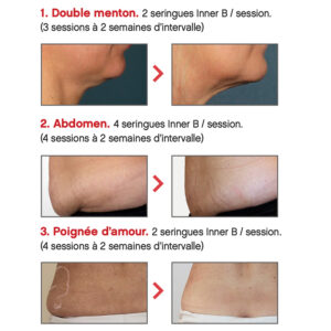 Prostrolane Inner B Prostrolane Inner B