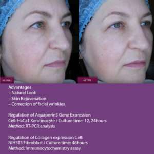 Prostrolane Natural B Prostrolane Natural B