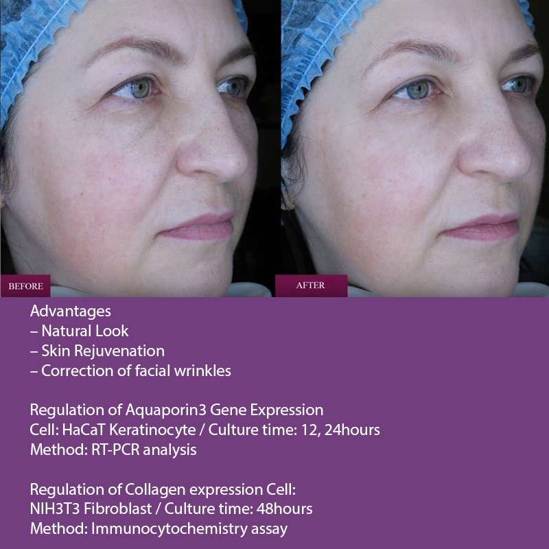 Prostrolane Natural B Prostrolane Natural B