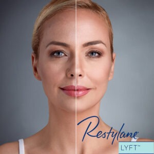 Restylane® Lyft with Lidocaine Restylane® Lyft with Lidocaine