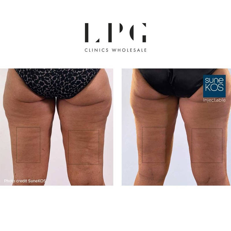 Sunekos ® Body Sunekos ® Body