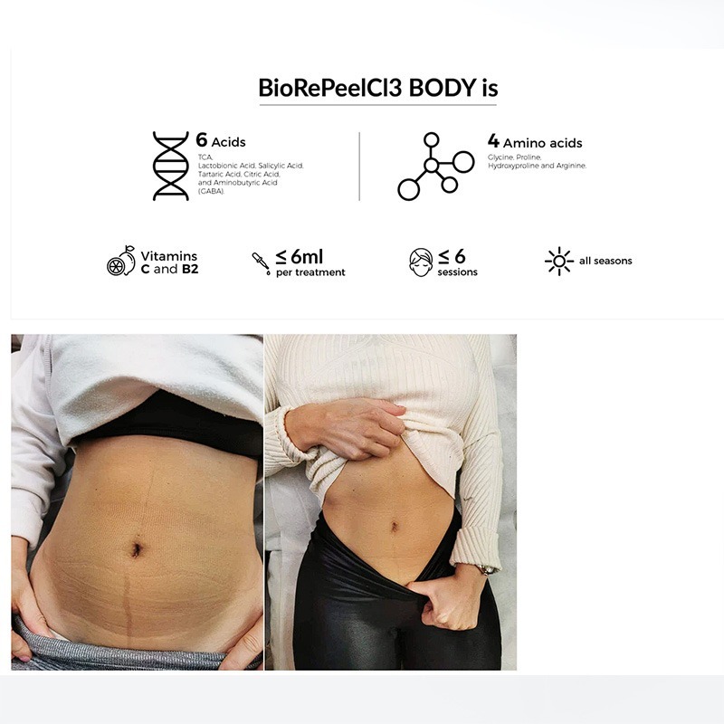 BioRePeelCl3 BODY BioRePeelCl3 BODY