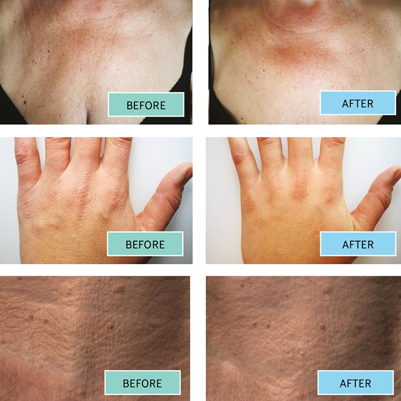 BioRePeelCl3 BODY BioRePeelCl3 BODY