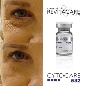 Cytocare 532 Cytocare 532