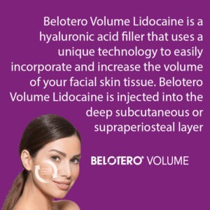 Belotero® Volume with Lidocaine Belotero® Volume with Lidocaine