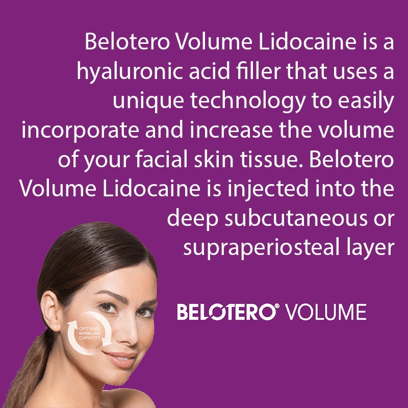 Belotero® Volume with Lidocaine Belotero® Volume with Lidocaine