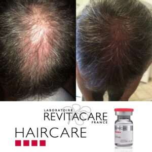 Haircare Before and After 4 Haircare Before and After 4