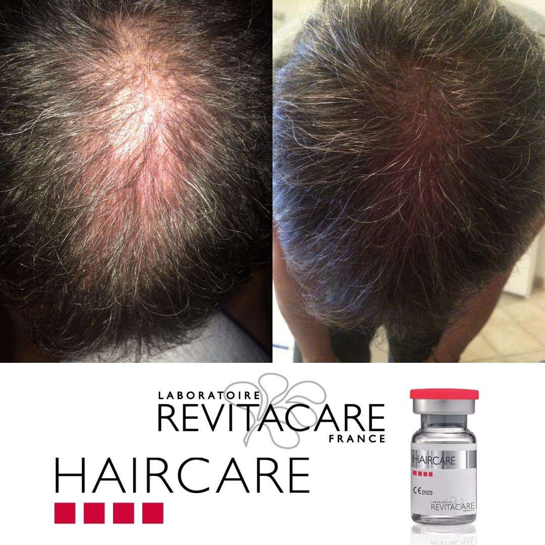 Haircare Before and After 4 Haircare Before and After 4