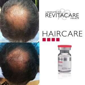 Haircare Before and After 5 Haircare Before and After 5