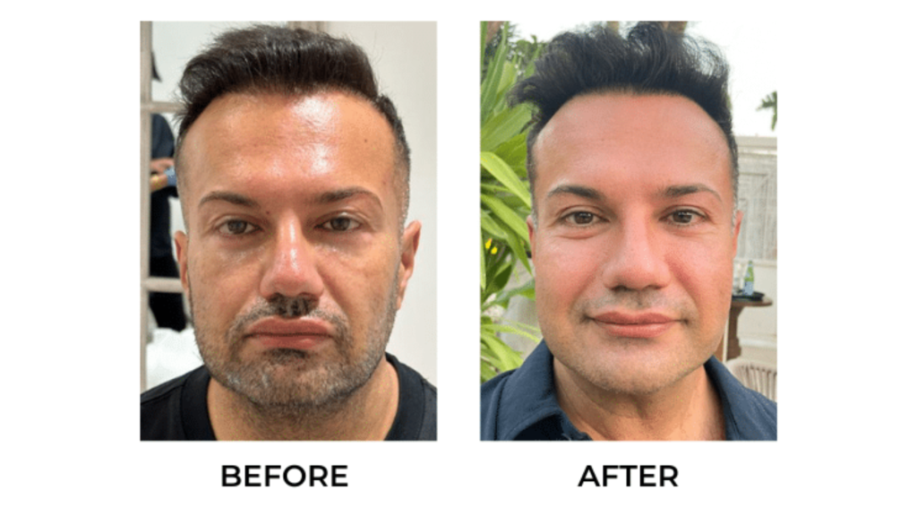 QiPvhAuAYo-2024-08-09-03-33-10 (1)