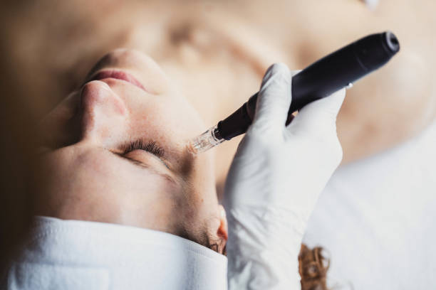 microneedling aftercare